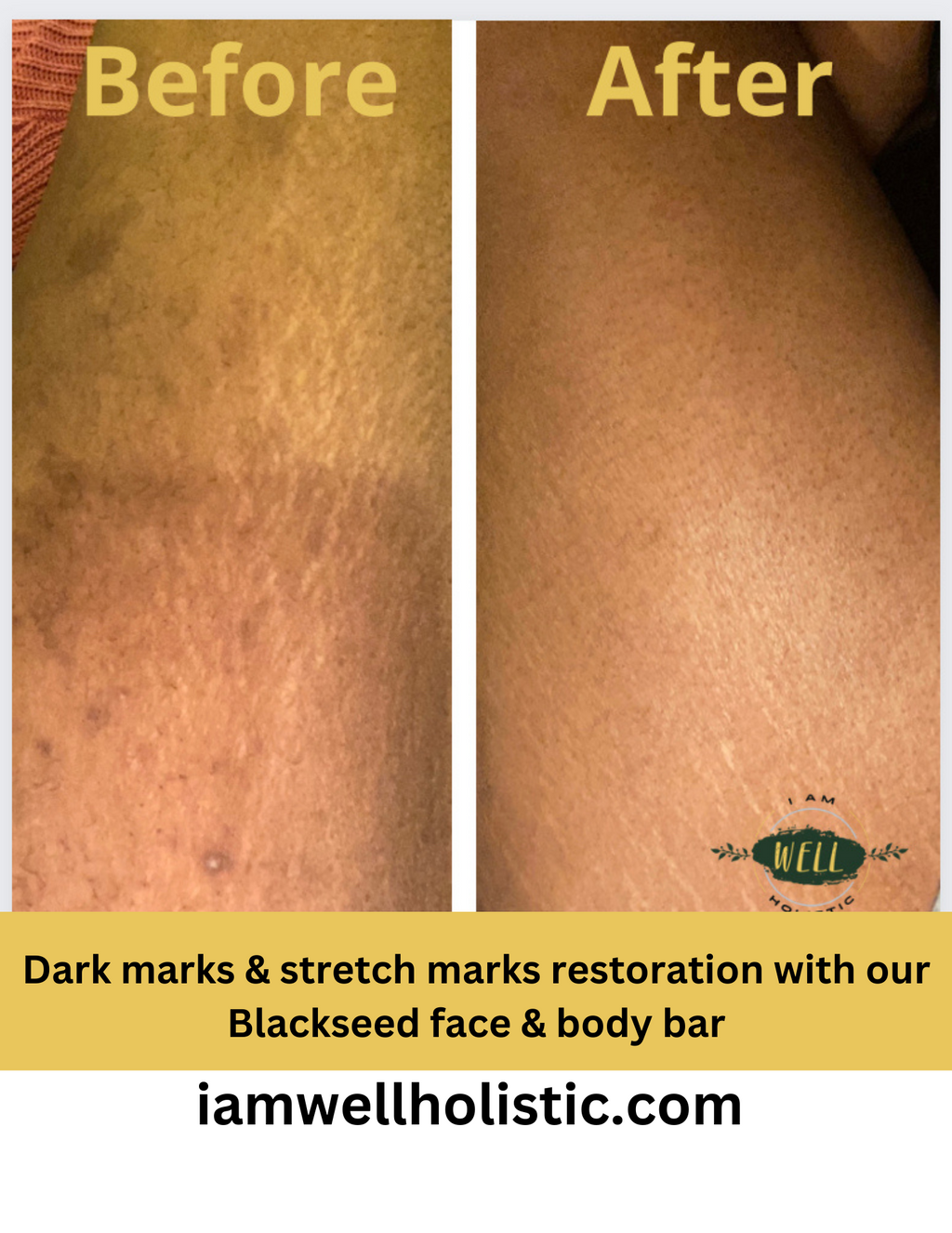 Black Seed face & Body Bar